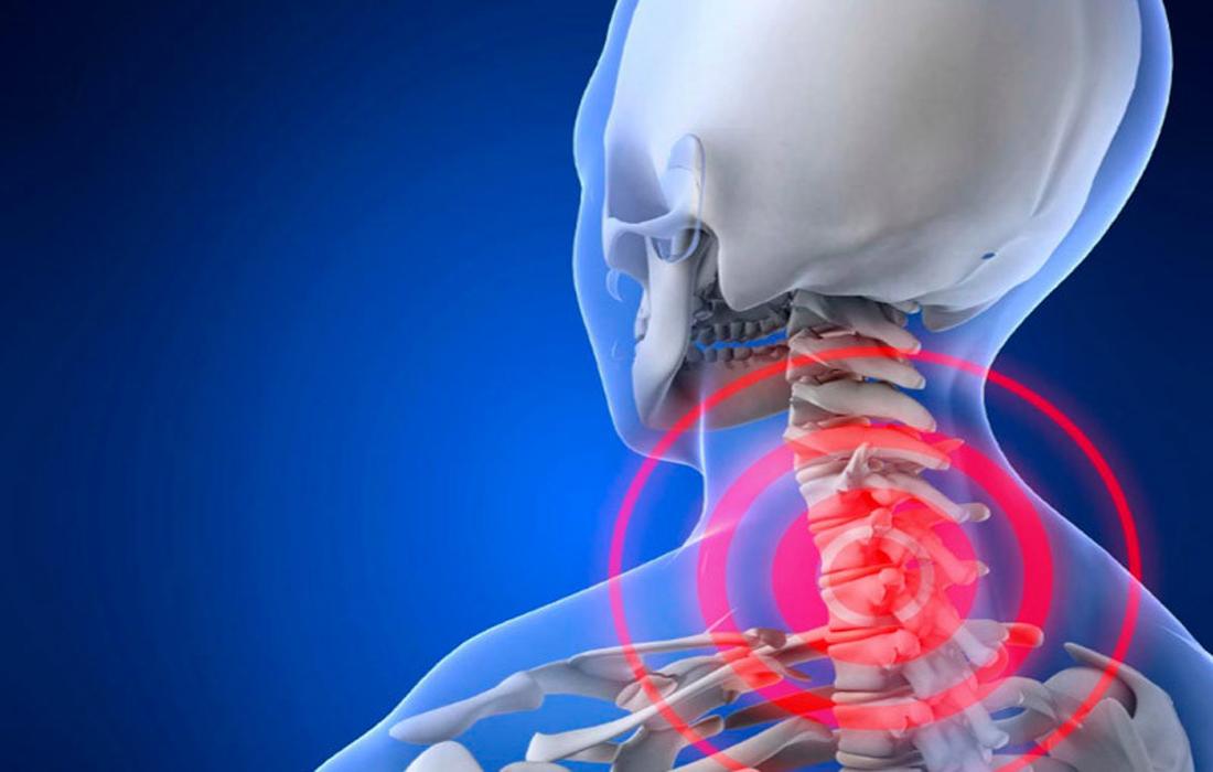 درد گردن و دیسک گردن چیست؟